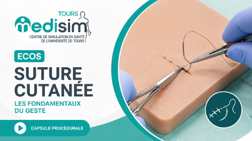 suture