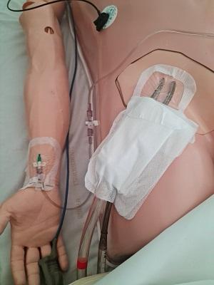 In situ ECMO MIR